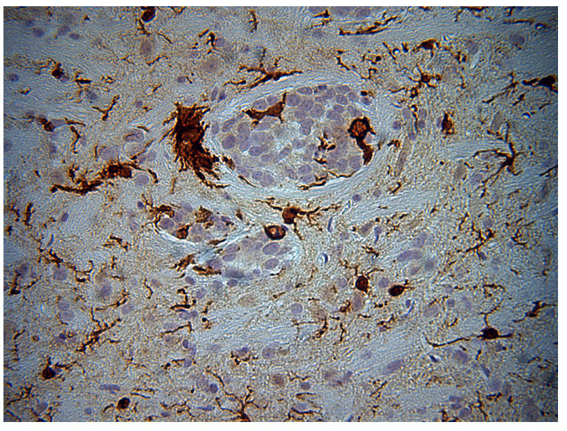 Brain of treated experimental subject.