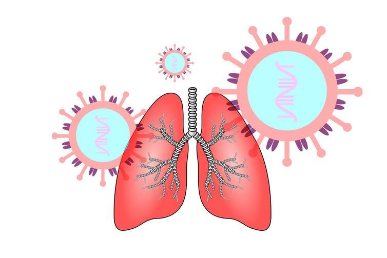 Coronavirus causes respiratory infections